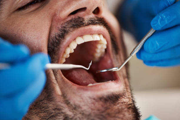 Full Mouth Reconstruction in Shippensburg University, PA